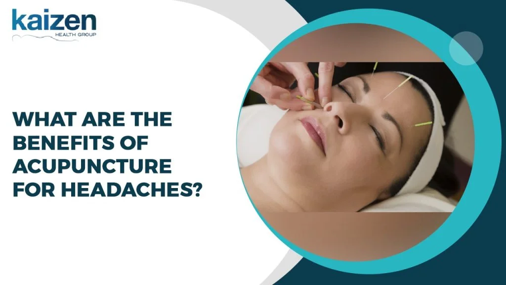 What are the benefits of Acupuncture for headaches