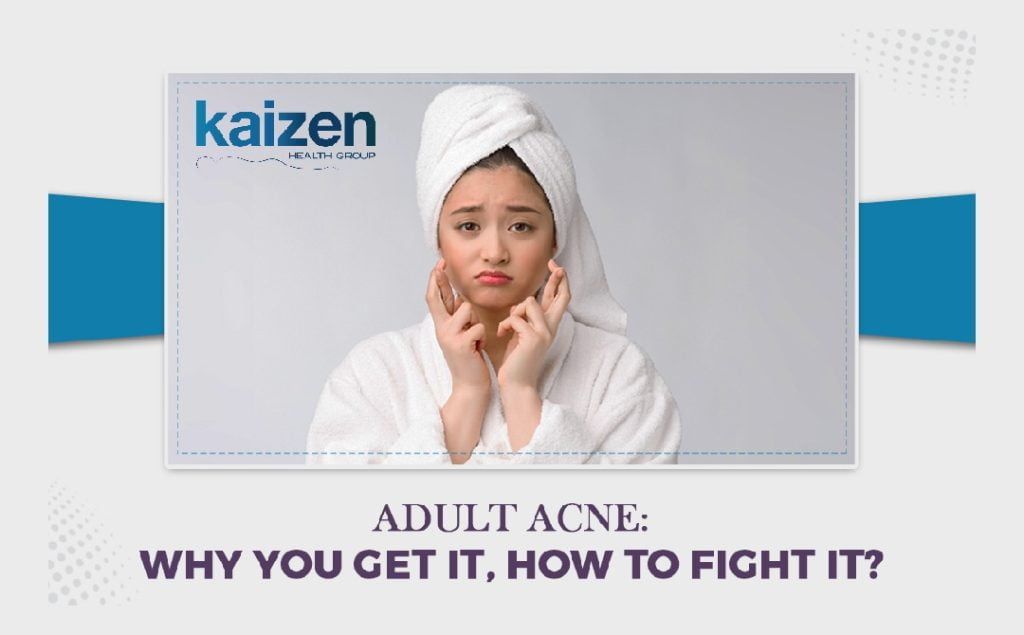 adult acne- why you get it, how to fight it- types by kaizen health group Mississauga