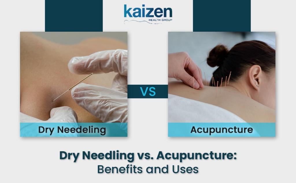 Dry needling vs. acupuncture Benefits and uses - Kaizen Health Group