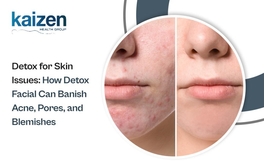 Detox for Skin Issues How Detox Facial Can Banish Acne, Pores, and Blemishes