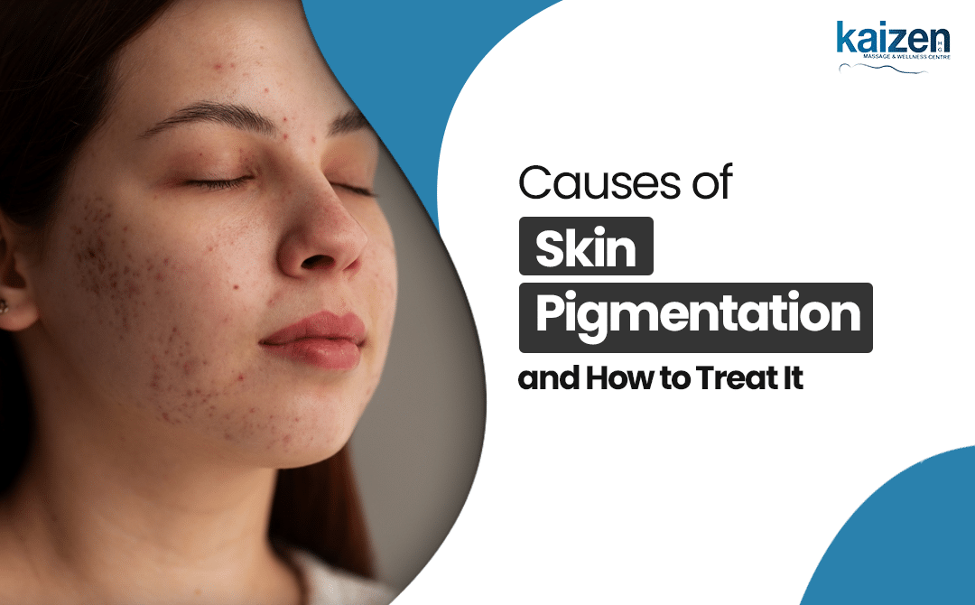Causes of Skin Pigmentation - Solution by kaizen health group