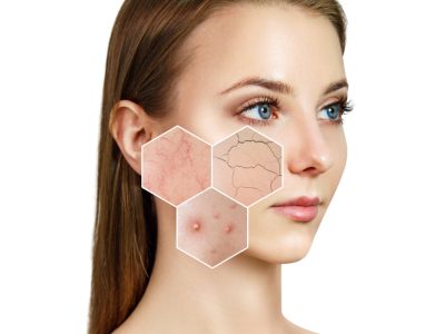 How Sensitive Skin Facials Contribute to Your Daily Routine-Kaizen Health Group